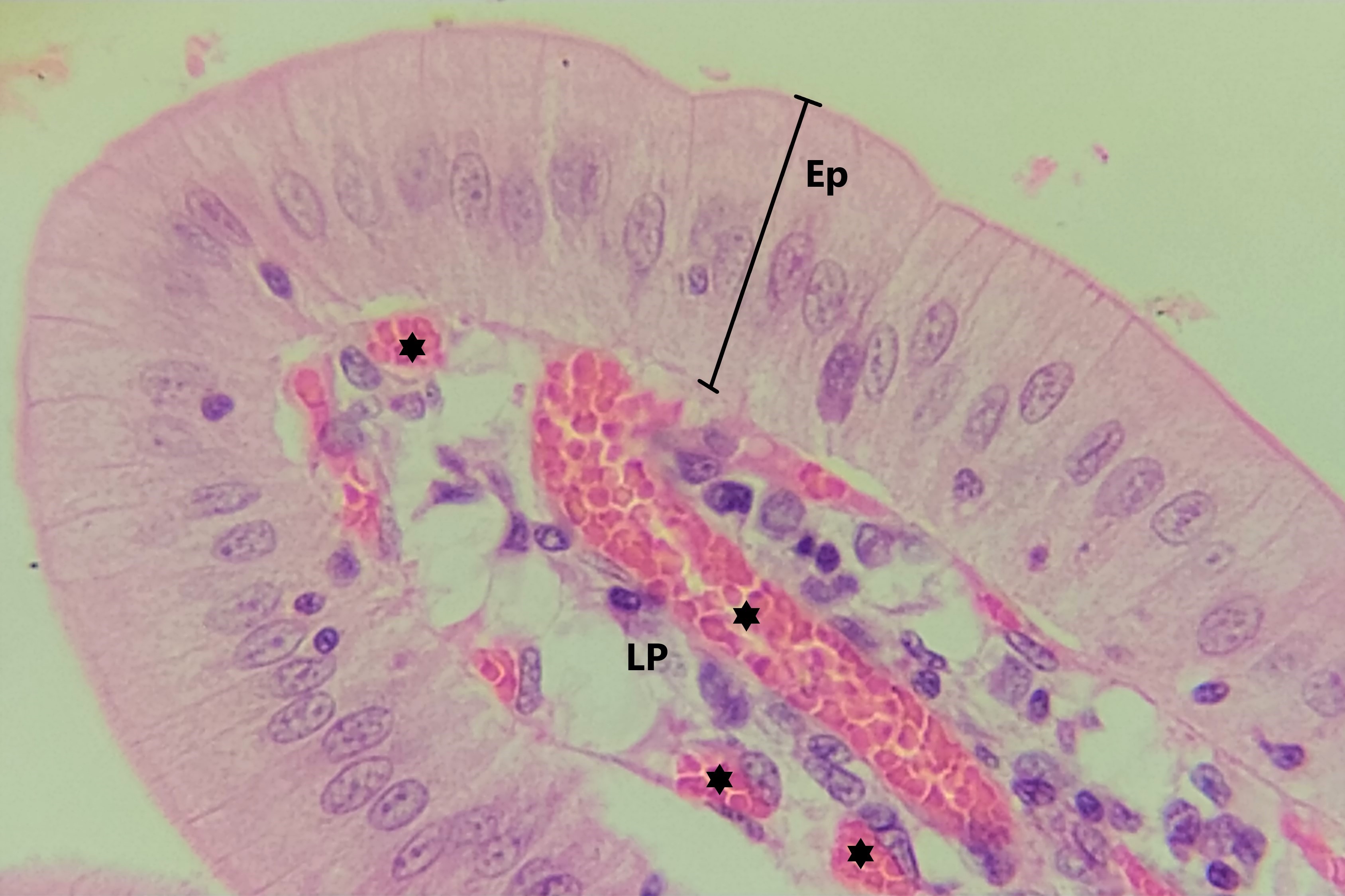 Lâmina: Intestino delgado - duodeno (H&E - Aumento: 400x). A fotomicrografia mostra a extremidade de uma vilosidade intestinal cuja superfície é revestida por um epitélio simples colunar (Ep).   Na região central dessa vilosidade é possível observar um tecido conjuntivo frouxo conhecido como lâmina própria (LP), com vasos sanguíneos (asteriscos), formando o cerne dessa vilosidade.