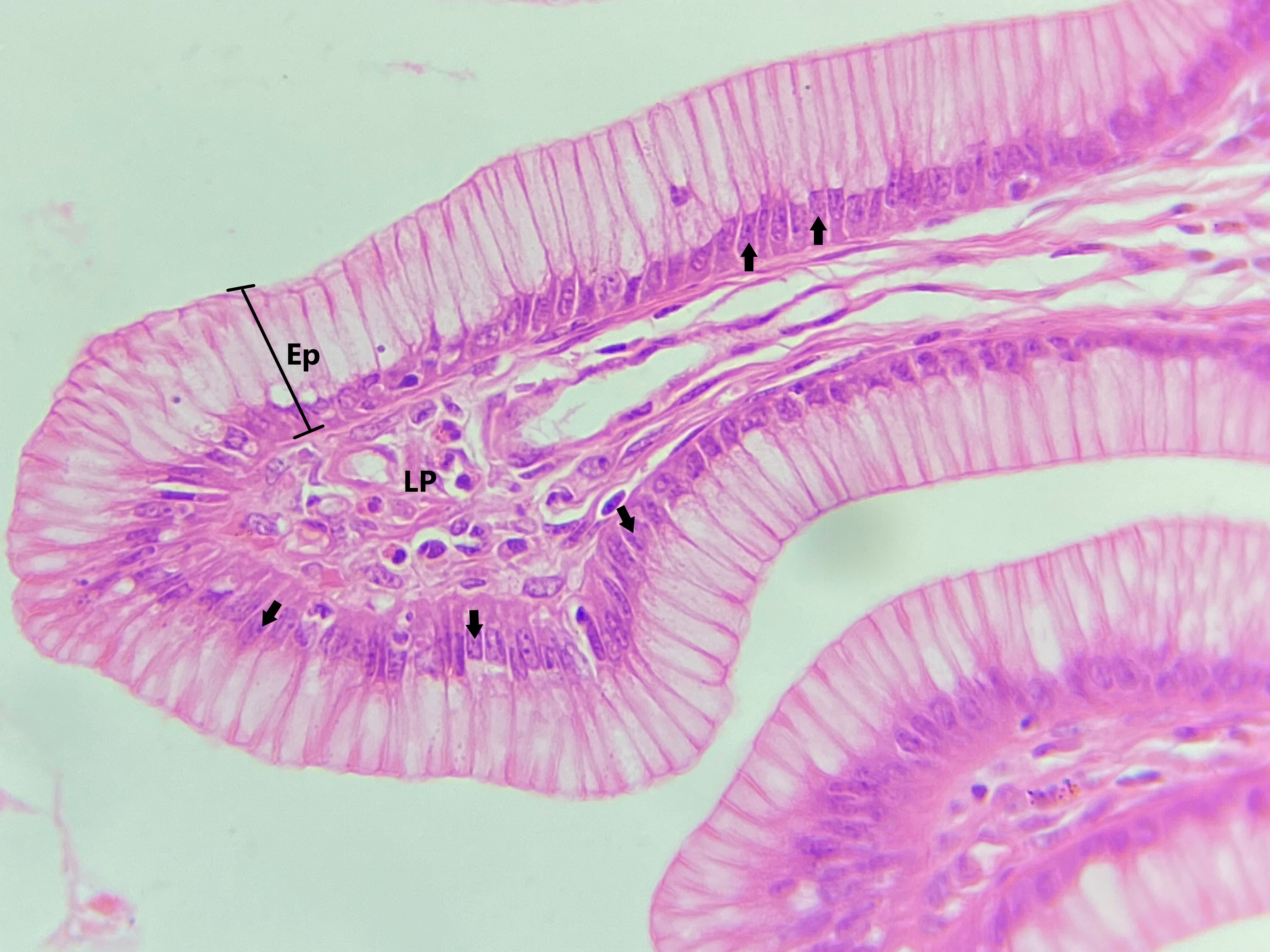 Lâmina: Estômago (H&E - Aumento: 400x). Nessa secção do estômago é possível observar o epitélio simples colunar (Ep), formado por uma única camada de células altas (colunares).  Os núcleos das células colunares (setas) são alongados (dispostos no sentido do eixo maior das células) e localizados na região basal das células. Abaixo do epitélio, nota-se a lâmina própria (LP) de tecido conjuntivo frouxo.