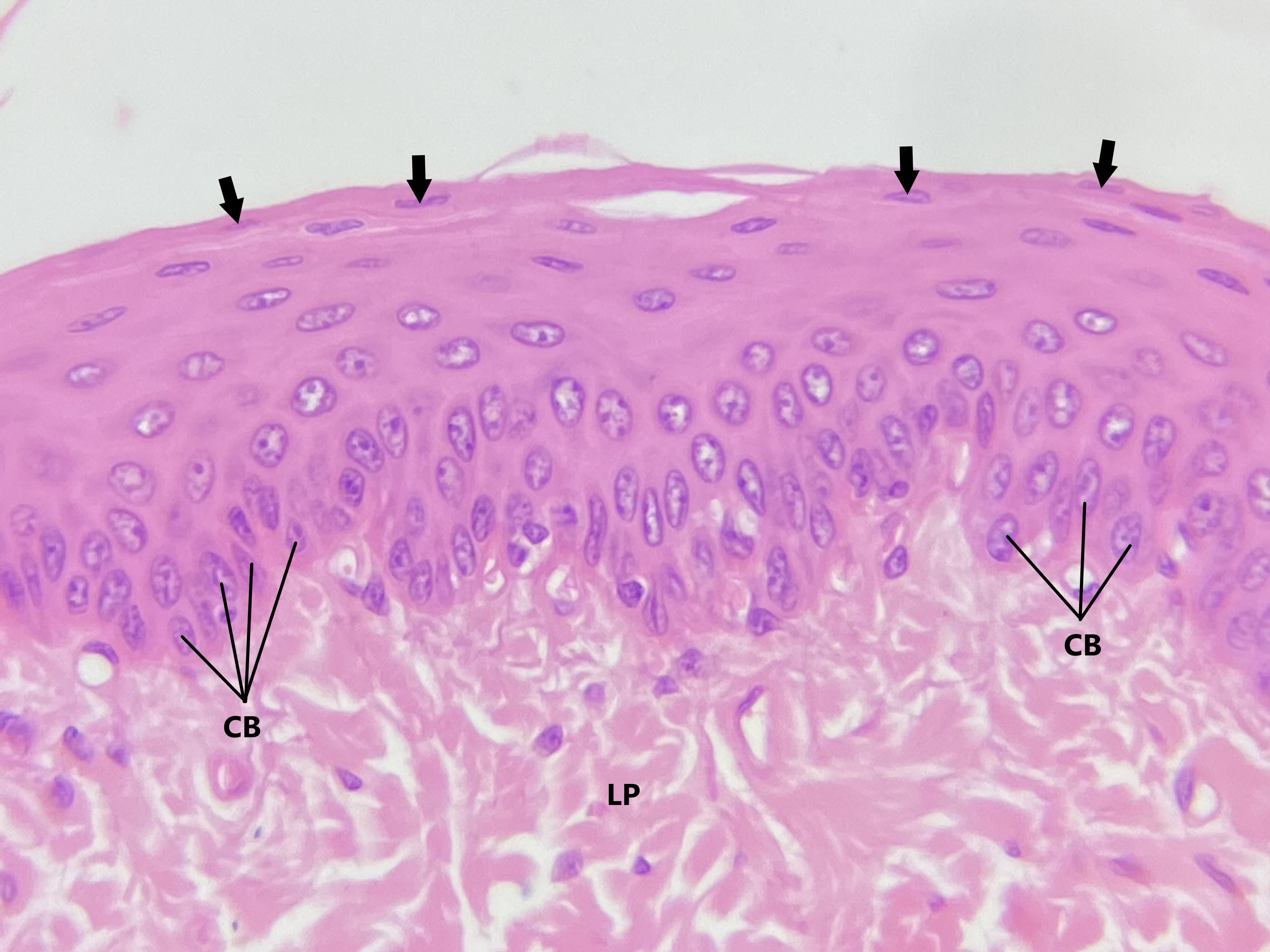 Lâmina: Esôfago (H&E - Aumento: 400x).  Epitélio estratificado pavimentoso não queratinizado do esôfago. As células da camada basal variam de cúbicas à colunares, o que pode ser constatado pelo formato de seus núcleos. Apenas as células da camada basal estão apoiadas sobre a membrana basal.  As células basais (CB) são menores e apresentam pouco citoplasma, o que explica maior proximidade dos núcleos entre si nessa região. O formato das células se altera à medida que essas células se movem para a superfície, até atingirem seu estado máximo de diferenciação, aonde passam a ser pavimentosas (setas). Consequentemente, há alteração também no formato dos núcleos nos diferentes níveis.