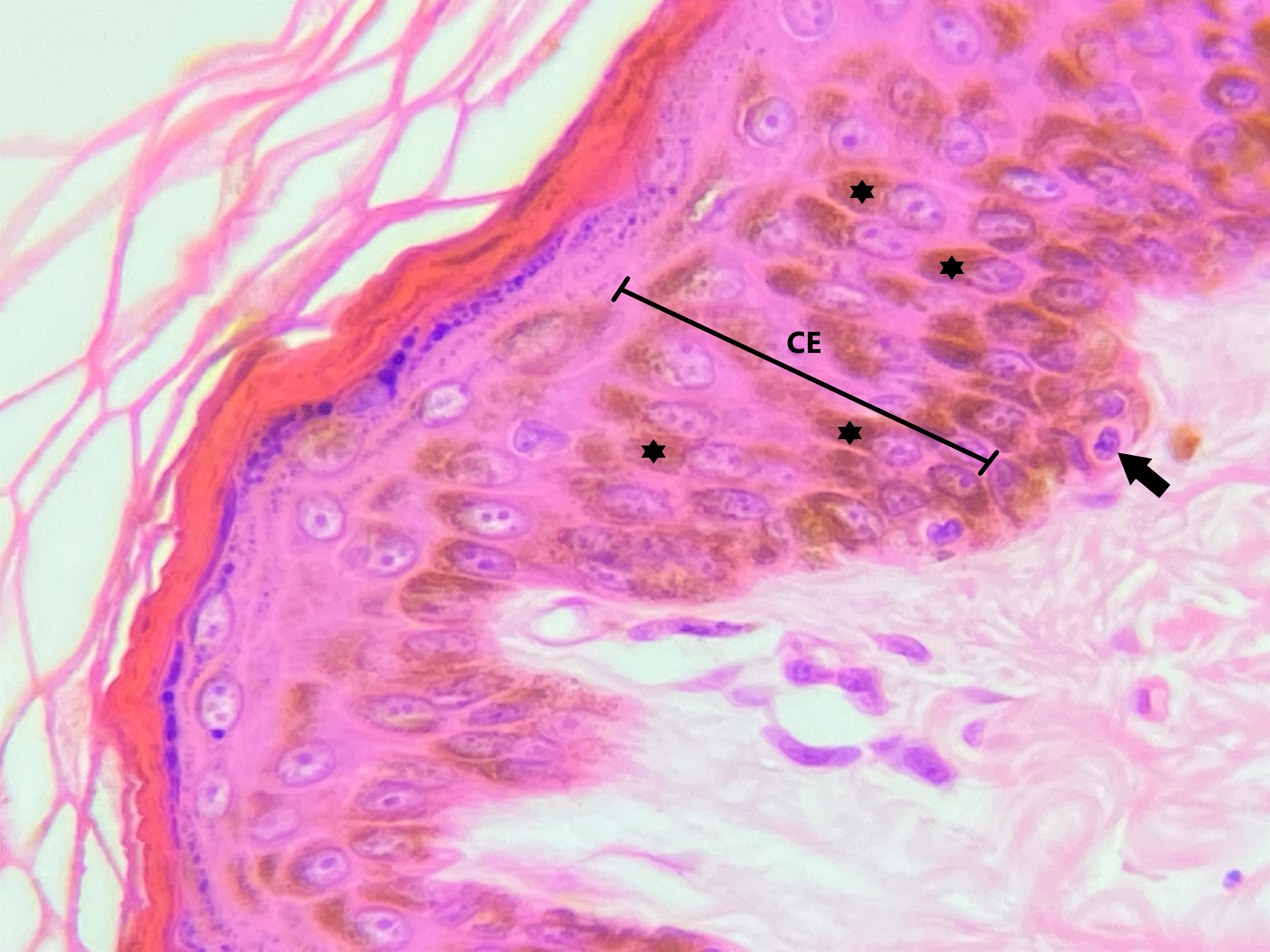 Lâmina: Pele fina (H&E - Aumento: 400x).  Epitélio estratificado pavimentoso queratinizado da pele delgada (ou fina). Na epiderme (Ep) o epitélio possui quatro camadas. A camada basal (CB), também conhecida como camada germinativa, observa-se uma única fileira de células que estão apoiadas sobre a lâmina/membrana basal. Na camada basal são encontradas células-tronco que serão responsáveis pela renovação do epitélio. Geralmente as células basais são pequenas e de formato cuboide.