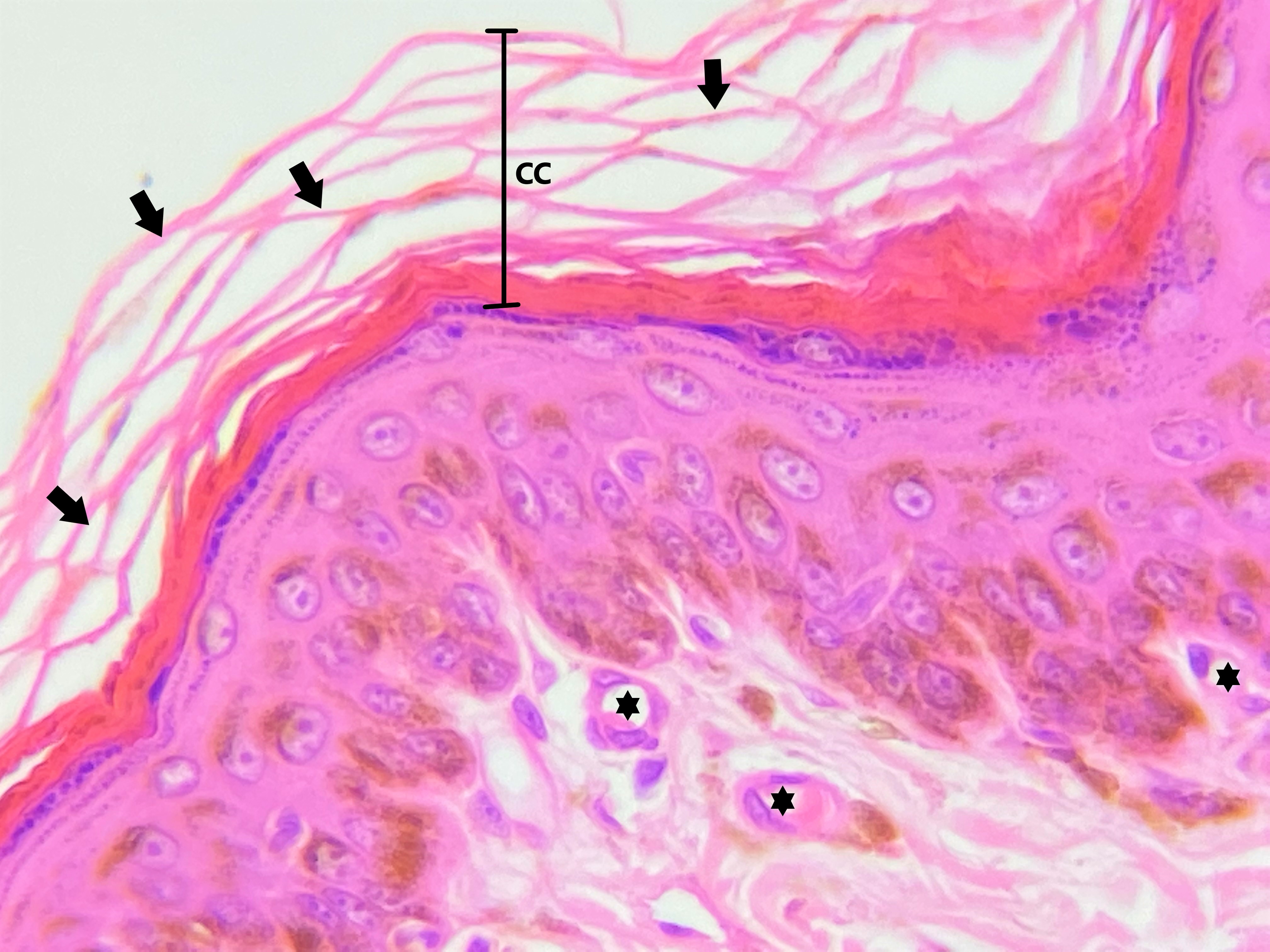 Lâmina: Pele fina (H&E - Aumento: 400x). Na camada córnea (CC), mais externa, as células pavimentosas perdem seus núcleos e organelas e armazenam grande quantidade de queratina, o que confere grande acidofilia.  Nas preparações histológicas de rotina, as células da camada córnea podem ser observadas como estruturas filamentosas (setas), que na verdade representam células em processo de descamação. Capilares sanguíneos (asteriscos) podem ser observados na derme papilar.
