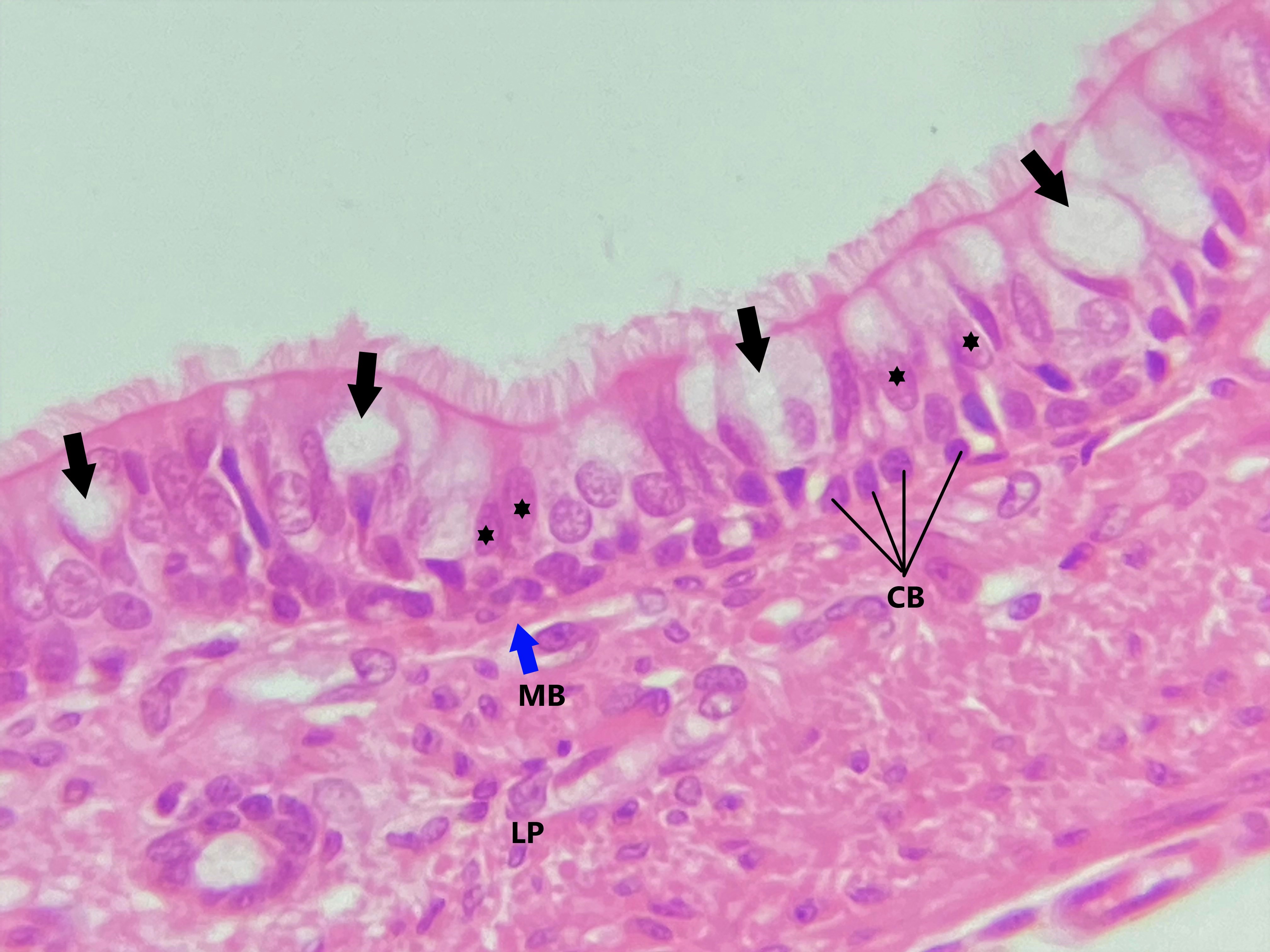 Lâmina: traqueia (H&E - Aumento: 400x). O principal tipo celular é a célula colunar ciliada, que possui núcleo de formato ovoide (asteriscos).  Entre as células colunares há as células caliciformes (setas), produtoras de muco e que aparecem palidamente coradas pela técnica H&E.  Os núcleos pequenos e arredondados na região basal do epitélio são das células basais (CB), que são células tronco responsáveis pela renovação do epitélio.  Embora apresentem núcleos em diferentes alturas, todas as células repousam sobre a membrana basal (MB).   Trata-se, portanto, de um epitélio simples, embora sua aparência sugira o contrário.