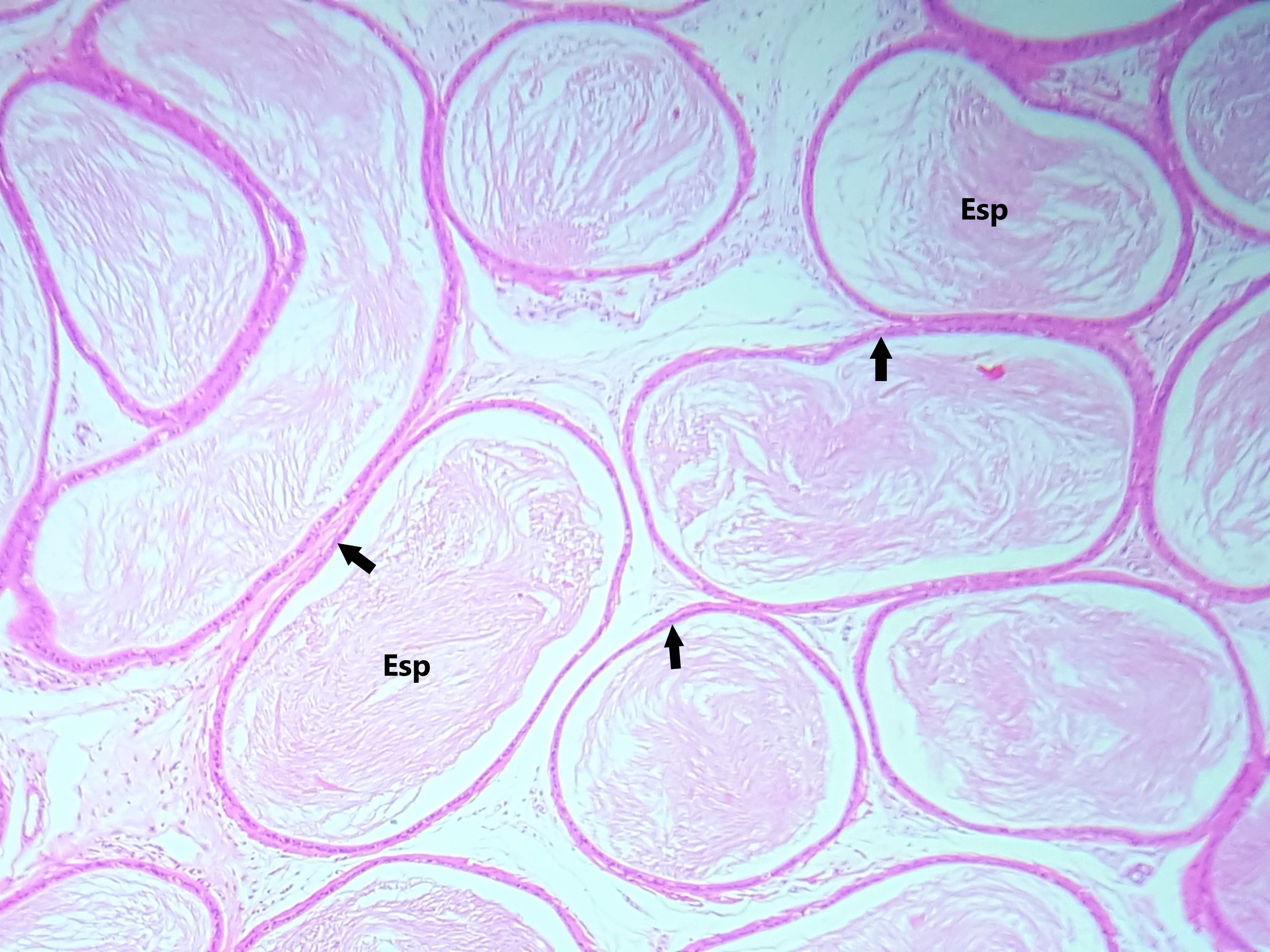Lâmina: Epidídimo (H&E - Aumento: 100x). Fotomicrografia mostrando cortes transversais do ducto epididimário. As setas apontam para o tecido epitelial pseudoestratificado colunar com estereocílios. É possível observar espermatozóides (Esp) no lúmen do ducto.