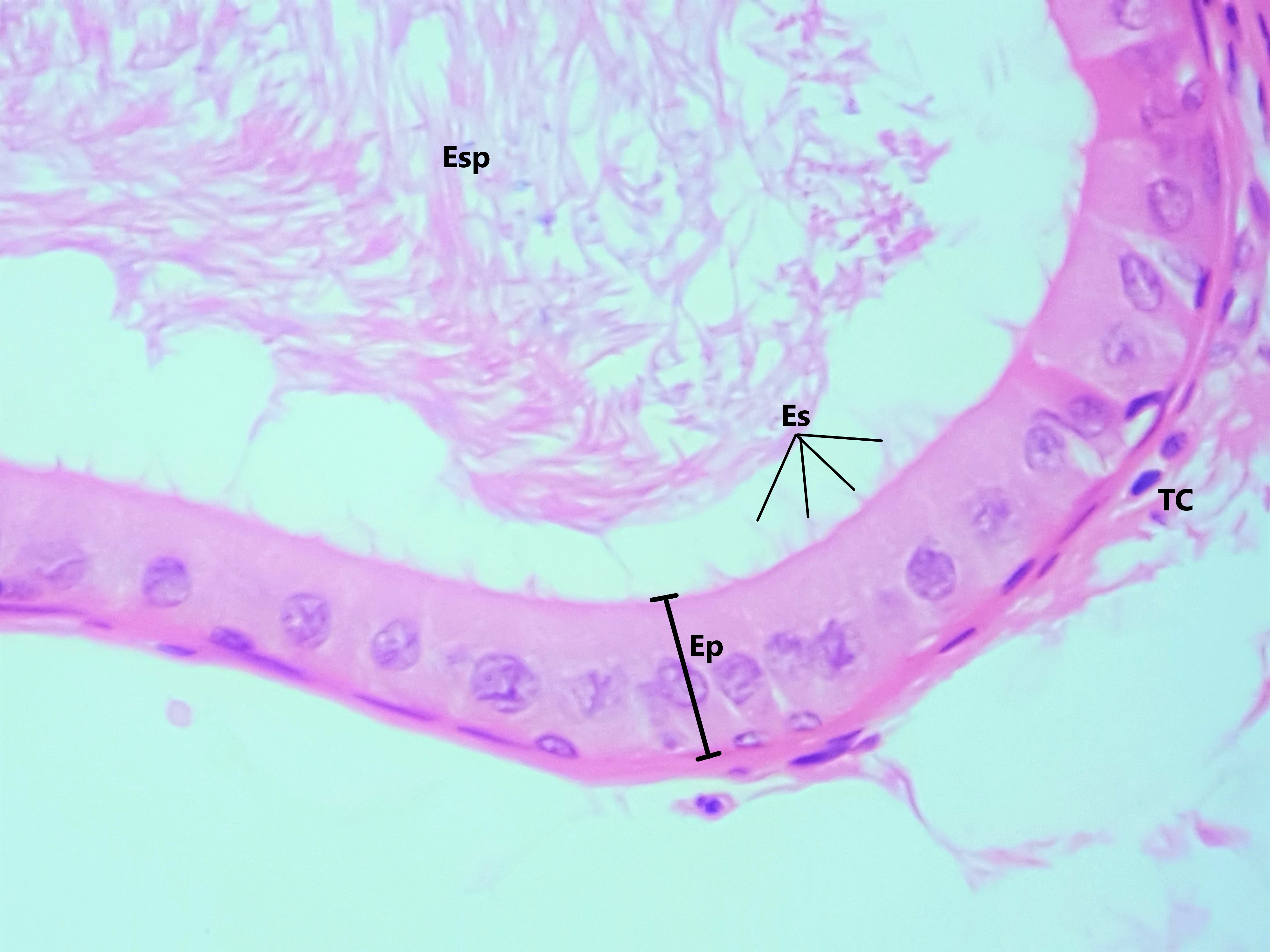 Lâmina: Epidídimo (H&E - Aumento: 400x). Em maior aumento evidenciando o epitélio pseudoestratificado colunar (Ep) com esterecílios (Es) que reveste o ducto epididimário. No estão espermatozódes (Esp) e subjacente ao epitélio, o tecido conjuntivo (TC).