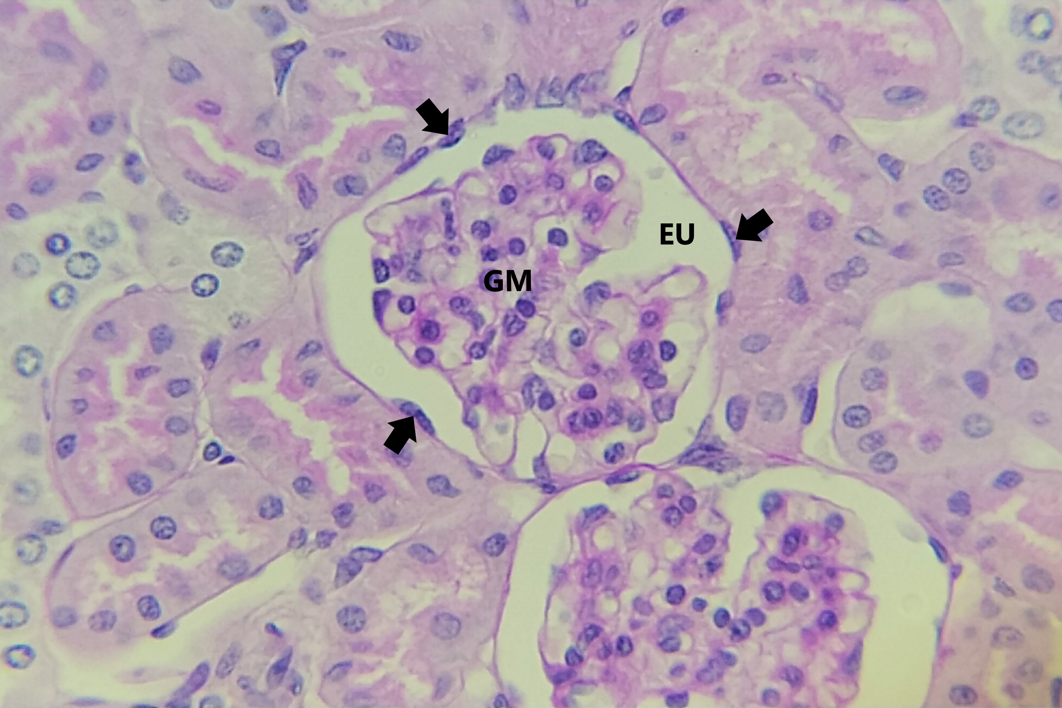 Lâmina: Rim - Córpúsculo renal (H&E - Aumento: 400x). A fotomicrografia ao lado mostra um corpúsculo renal. O corpúsculo é uma estrutura esférica contendo um glomérulo (GM) (tufos de capilares) que é circundado pela cápsula renal (de Bowman). O folheto mais externo da cápsula renal, conhecido como folheto parietal, consiste no epitélio simples pavimentoso.  Os núcleos (setas) das células pavimentosas do folheto parietal são de aspecto ovoide e fazem uma leve saliência para o interior do espaço urinário (EU).